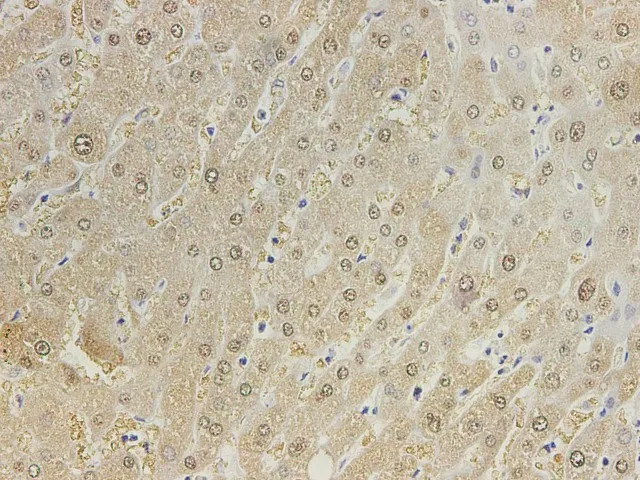 GSTA1 Polyclonal Antibody - image 3