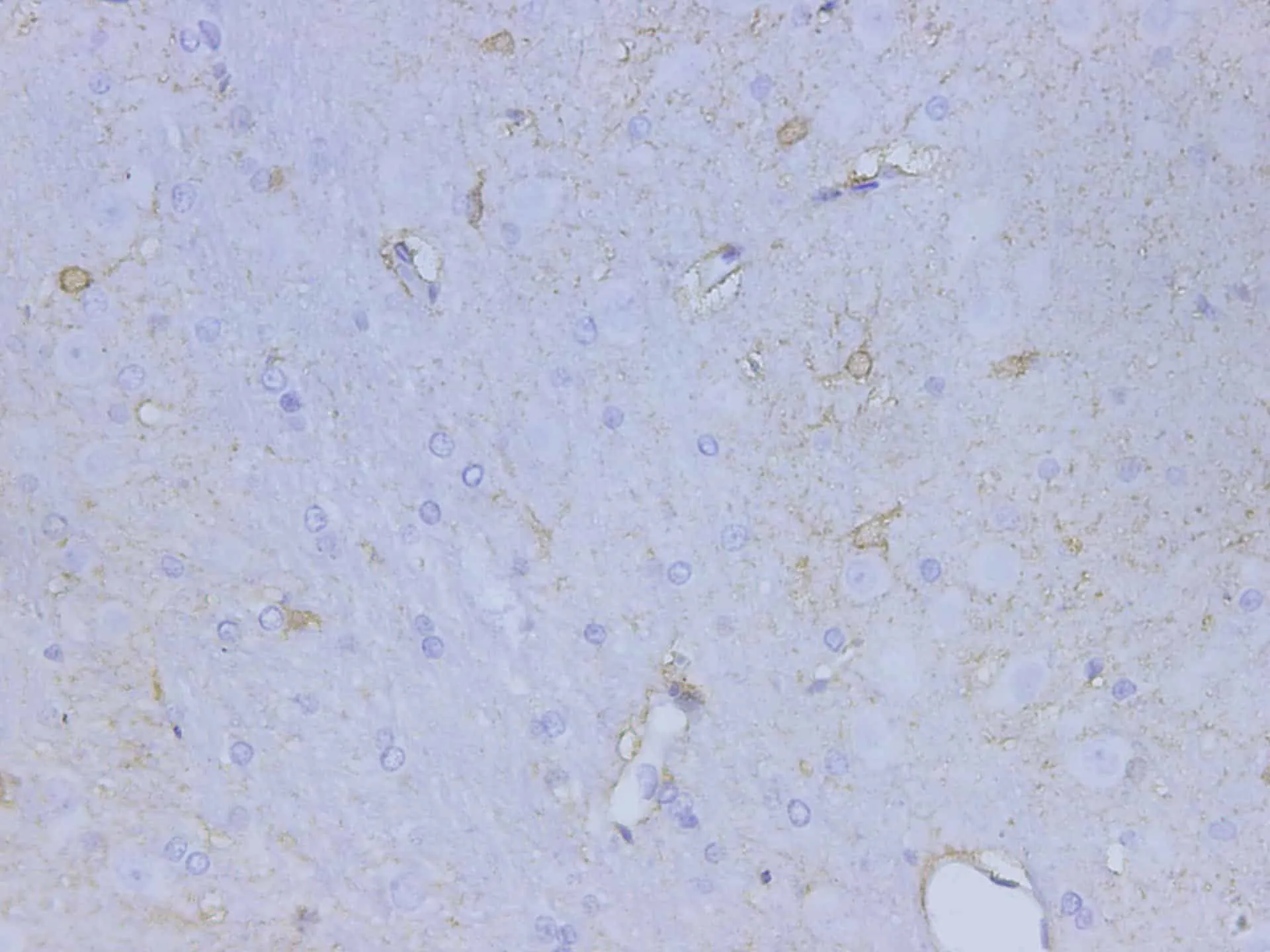 S100B Polyclonal Antibody - image 1