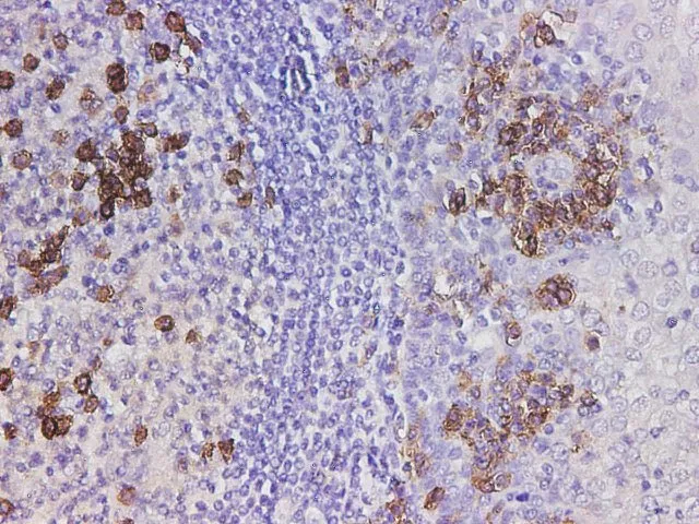 CD38 Polyclonal Antibody - image 2