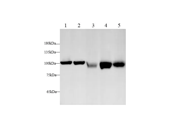 EEF2 Polyclonal Antibody - image 1