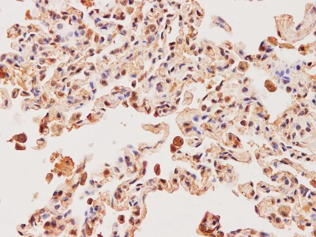 EEF2 Polyclonal Antibody - image 2