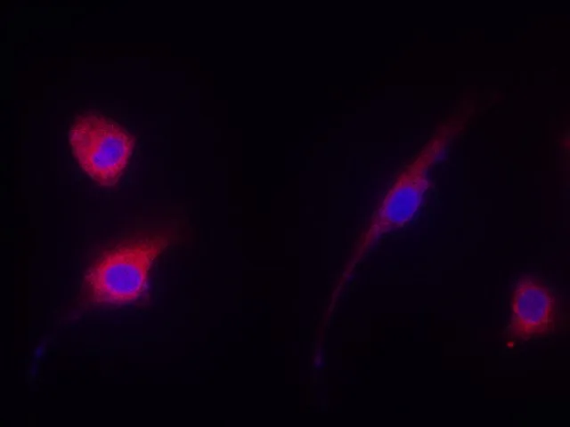 EEF2 Polyclonal Antibody - image 3