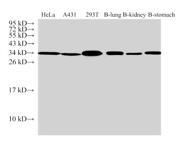 ANXA5 Polyclonal Antibody - image 1