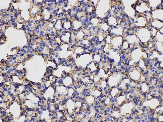 ANXA5 Polyclonal Antibody - image 4