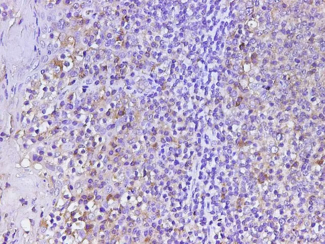 CD74 Polyclonal Antibody - image 1