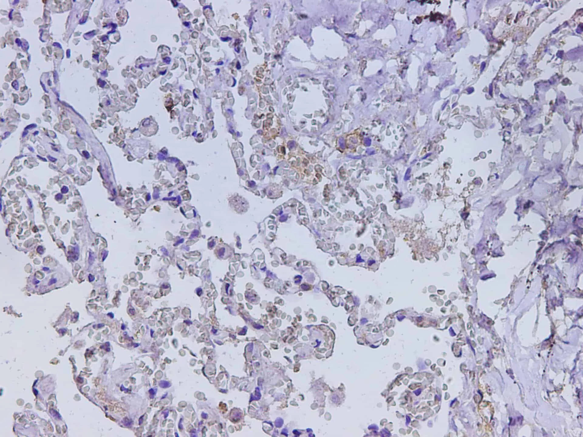CD74 Polyclonal Antibody - image 2