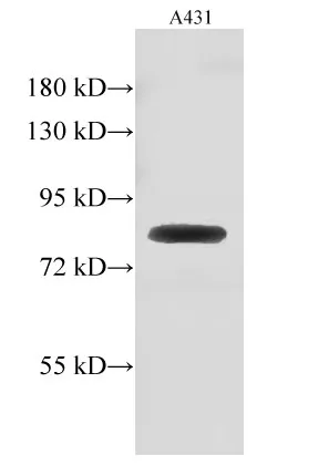 GUSB Polyclonal Antibody - image 1