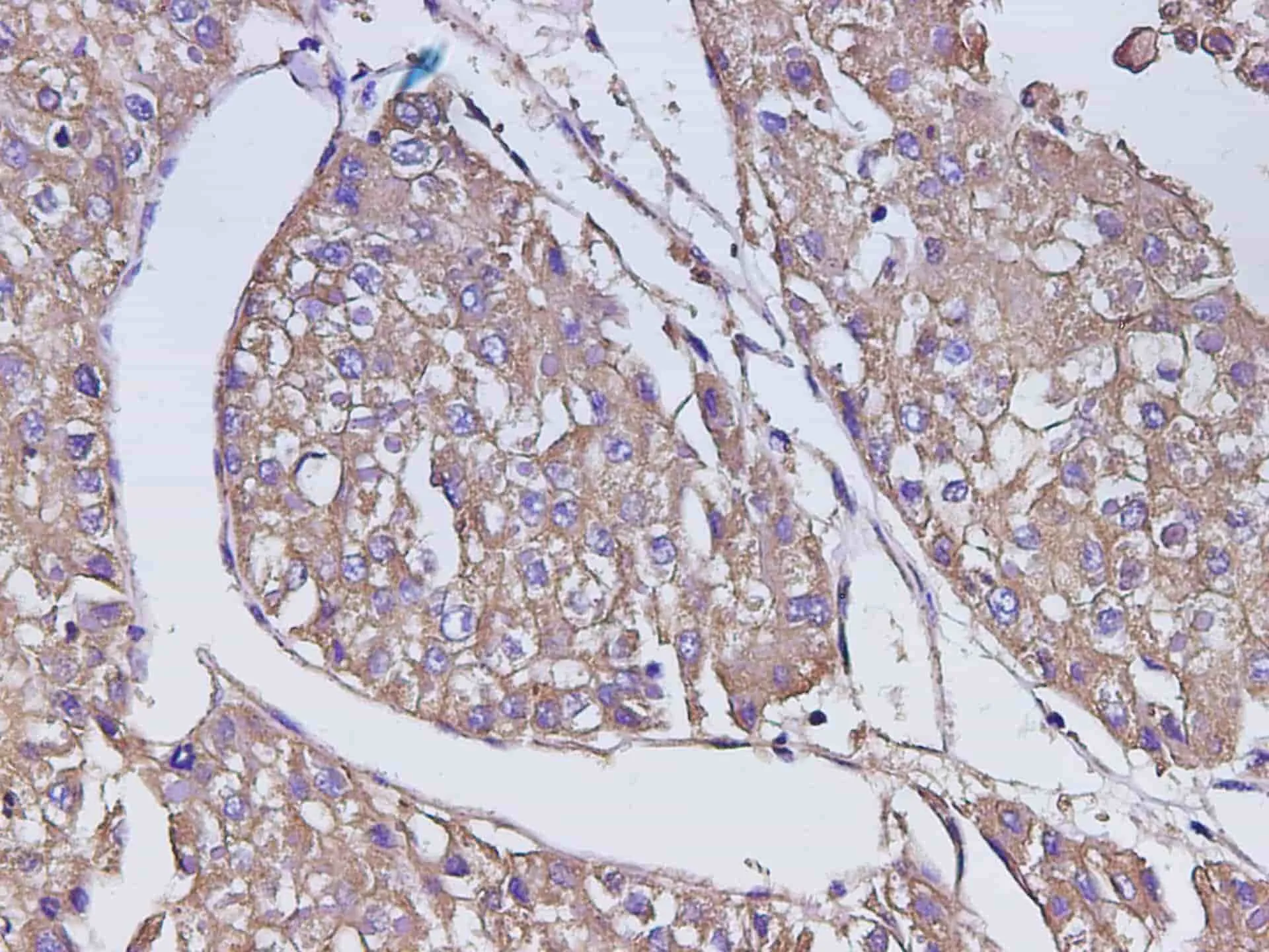 AFP Polyclonal Antibody - image 1
