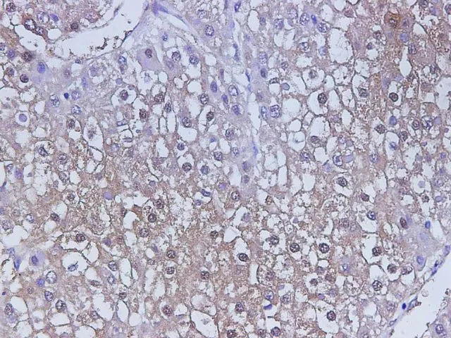 CST3 Polyclonal Antibody - image 2