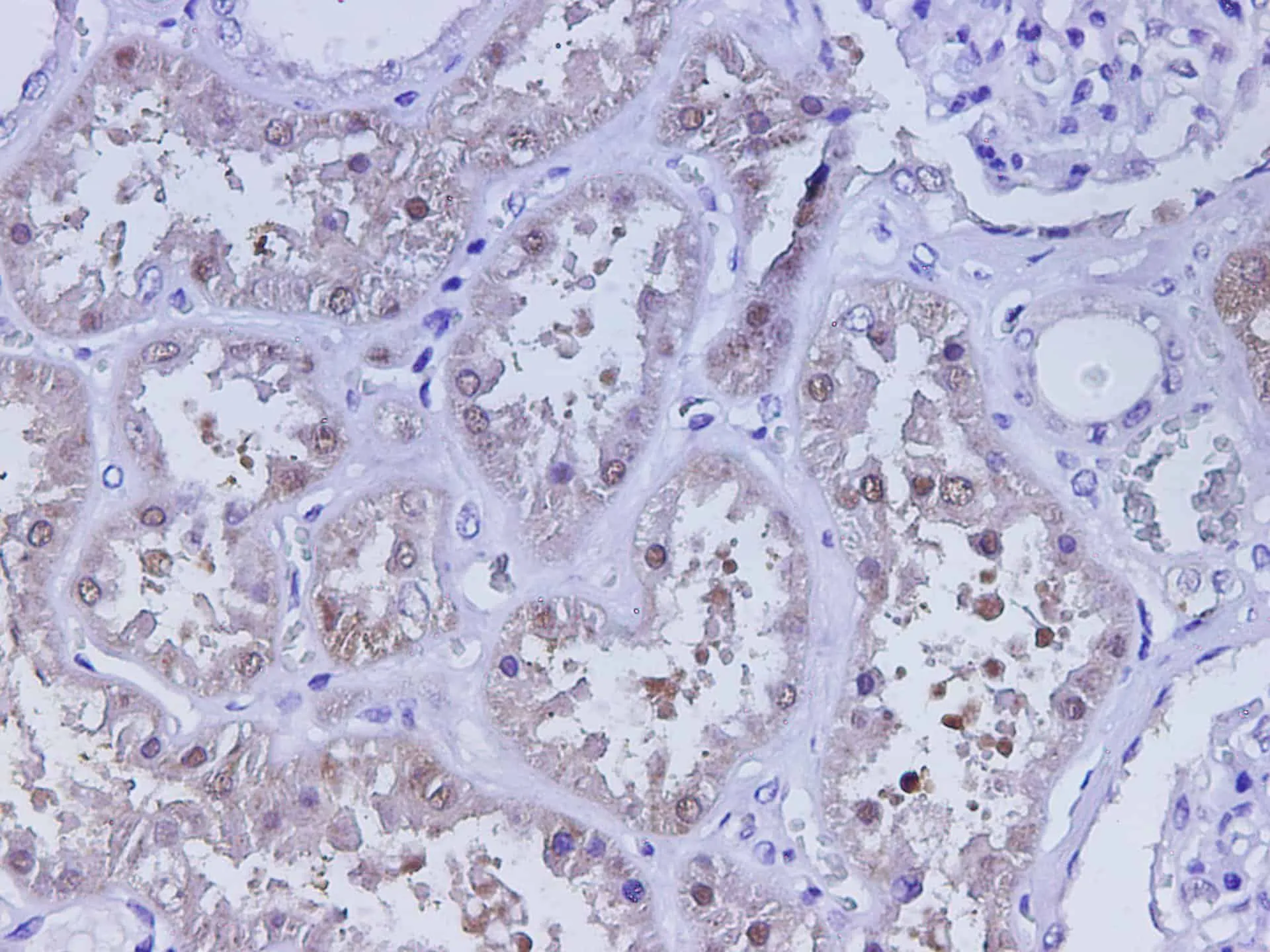 CST3 Polyclonal Antibody - image 3