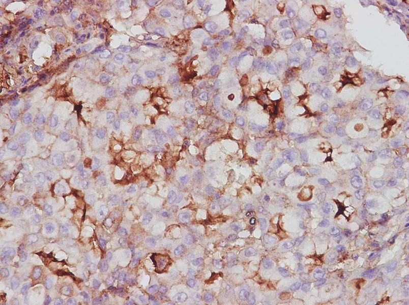 ESM1 Polyclonal Antibody - image 1