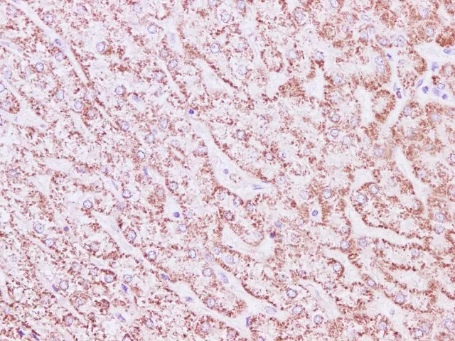 SDHA Polyclonal Antibody - image 2