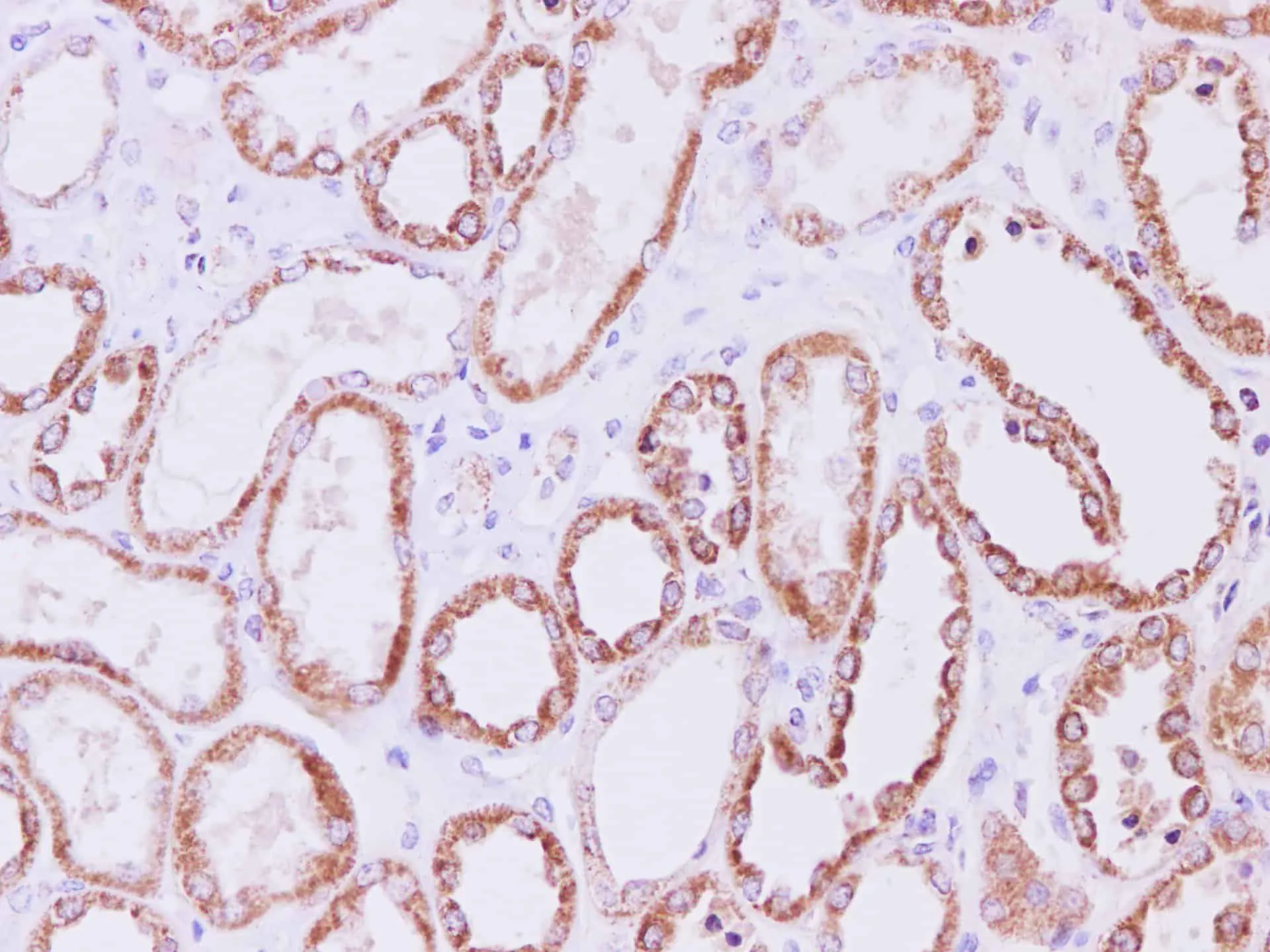 SDHA Polyclonal Antibody - image 3