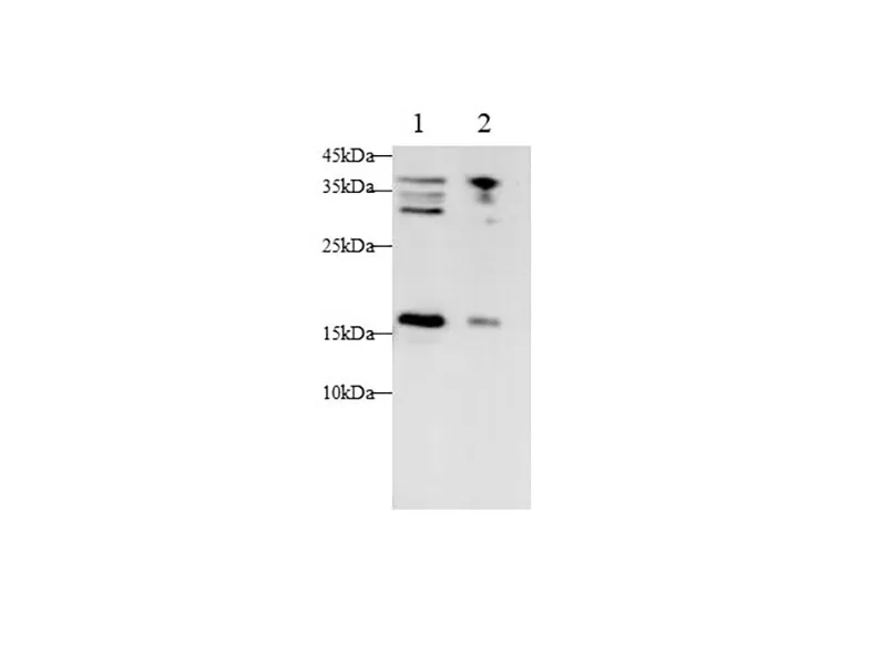 CDKN2A Polyclonal Antibody - image 1