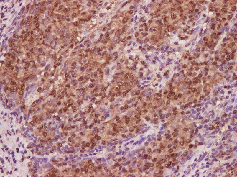 CDKN2A Polyclonal Antibody - image 2