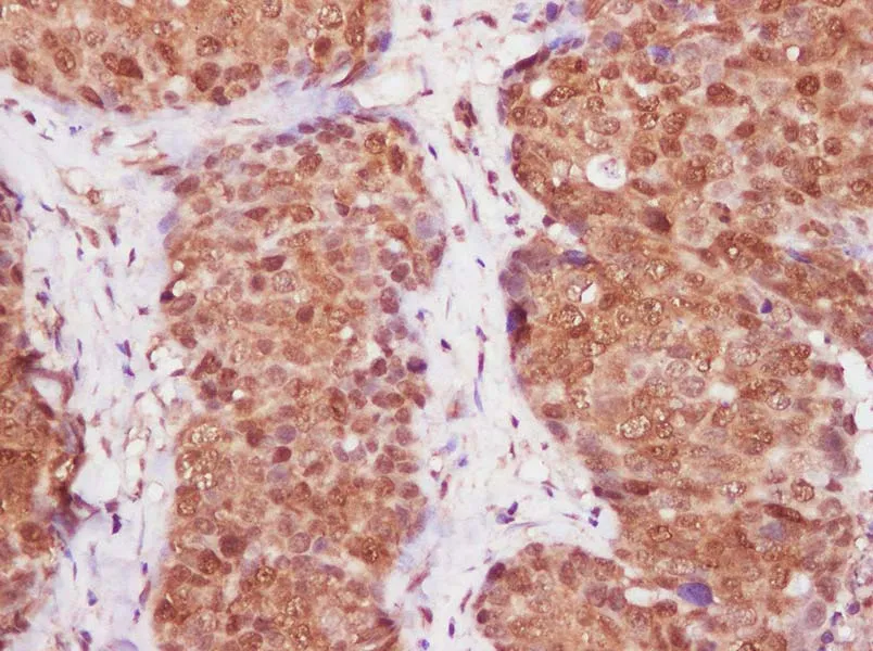 CDKN2A Polyclonal Antibody - image 3
