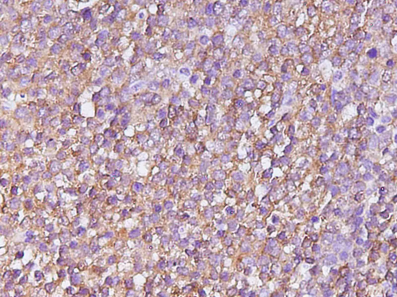 CASP4 Polyclonal Antibody - image 1