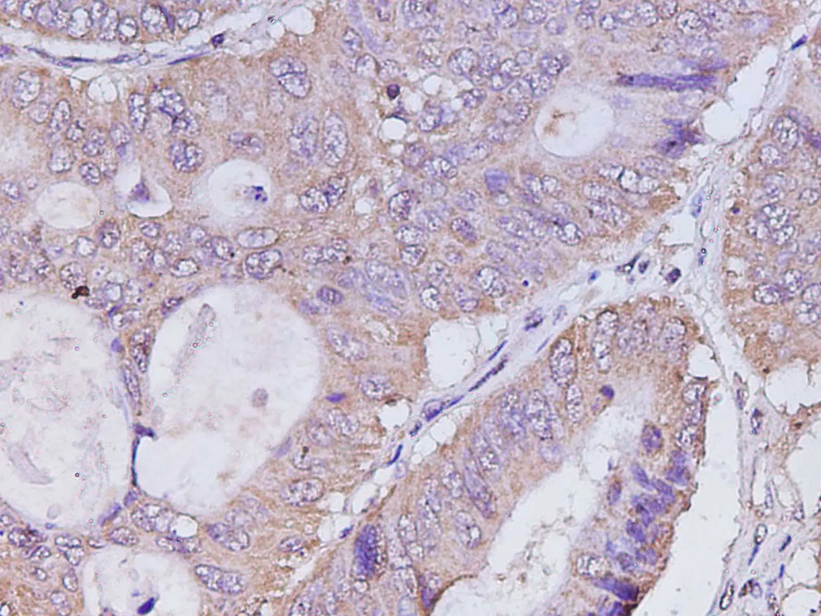 CASP4 Polyclonal Antibody - image 2