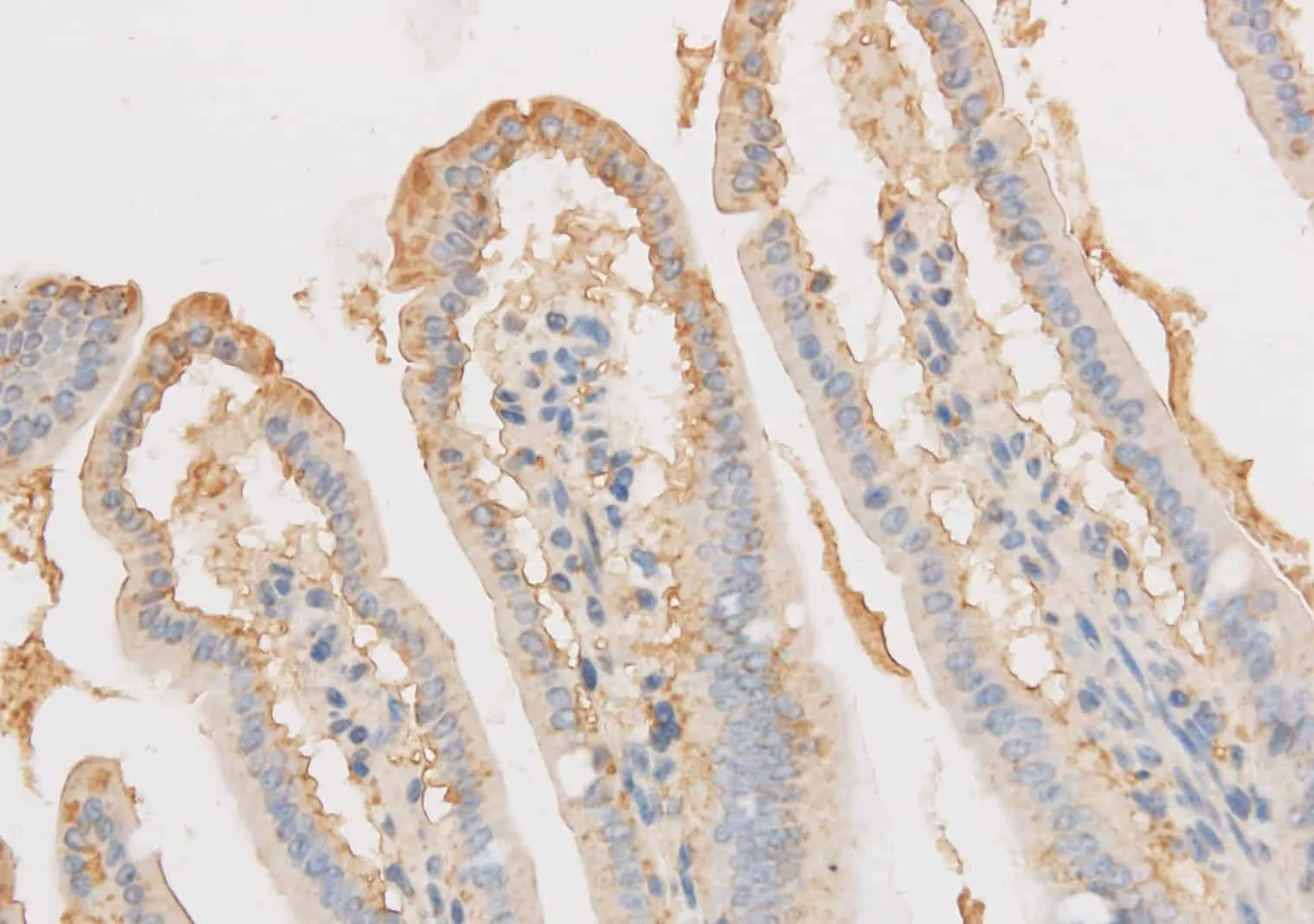 VDAC1 Polyclonal Antibody - image 1