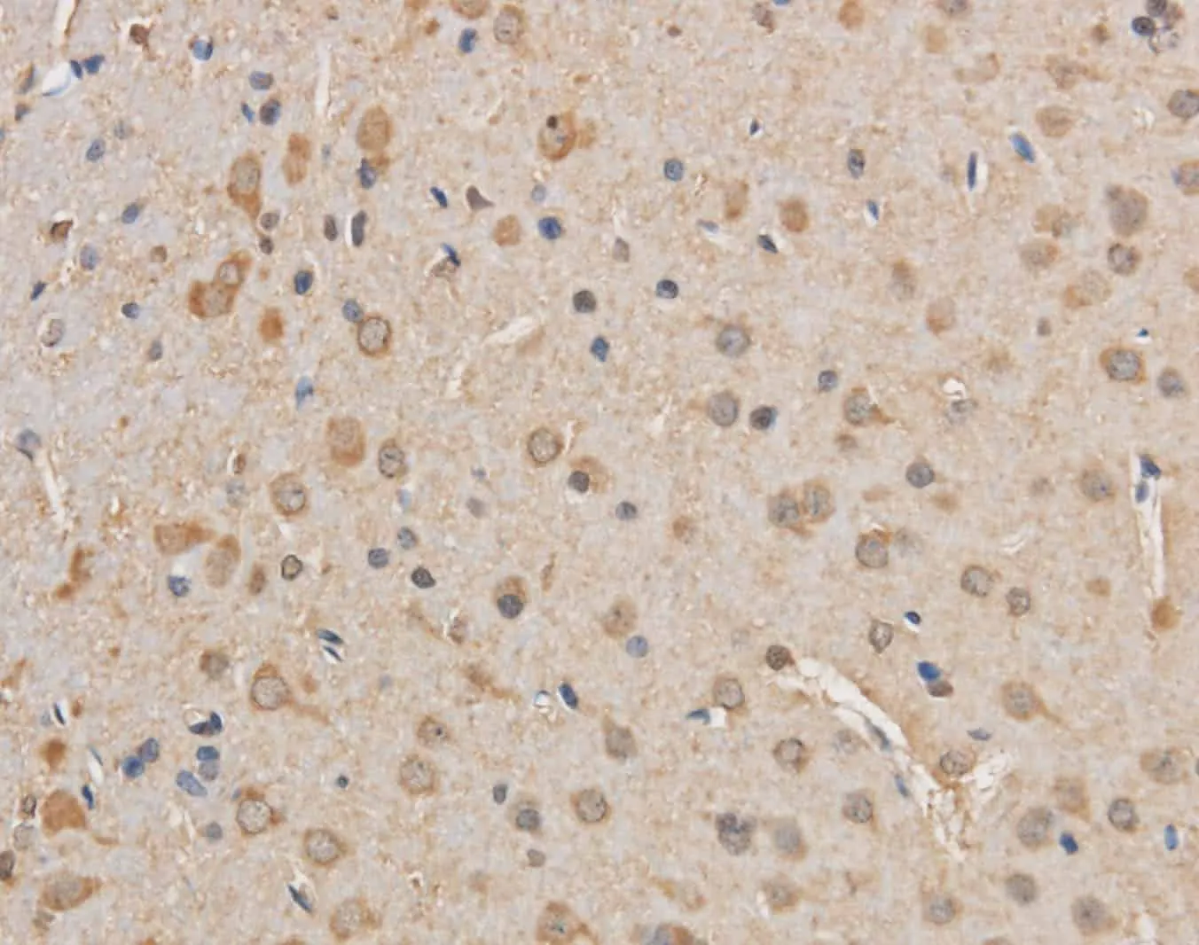 VDAC1 Polyclonal Antibody - image 2