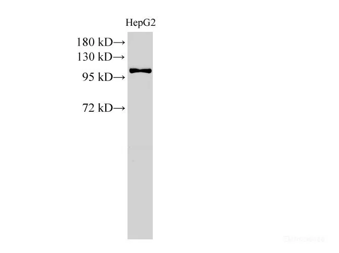 MCM3 Polyclonal Antibody - image 1