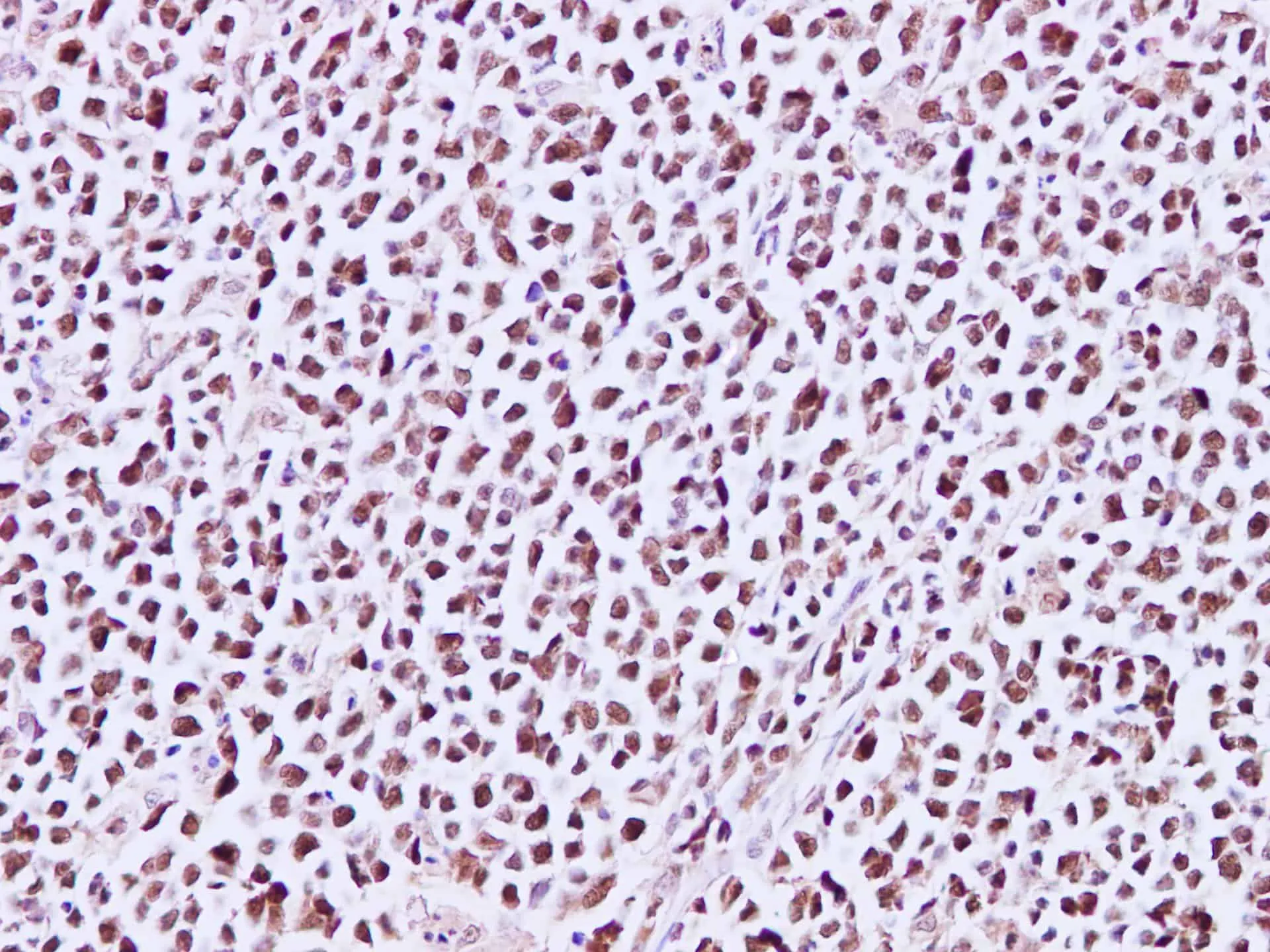 MCM3 Polyclonal Antibody - image 3