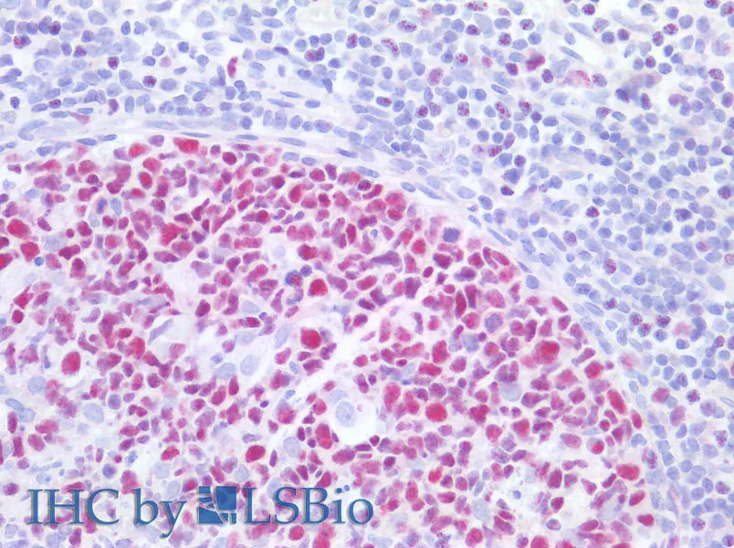 MCM3 Polyclonal Antibody - image 4