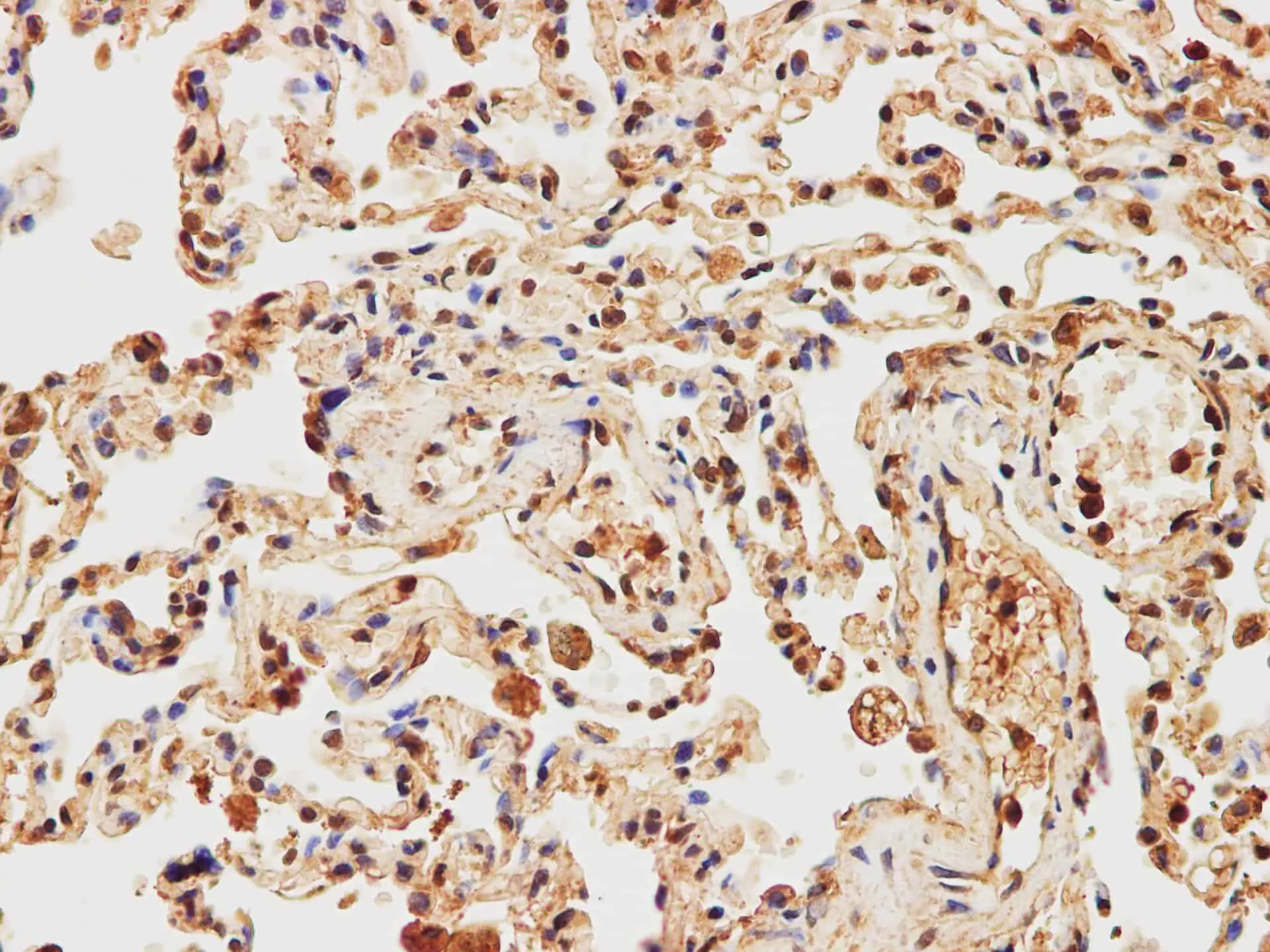 IMP3 Polyclonal Antibody - image 2