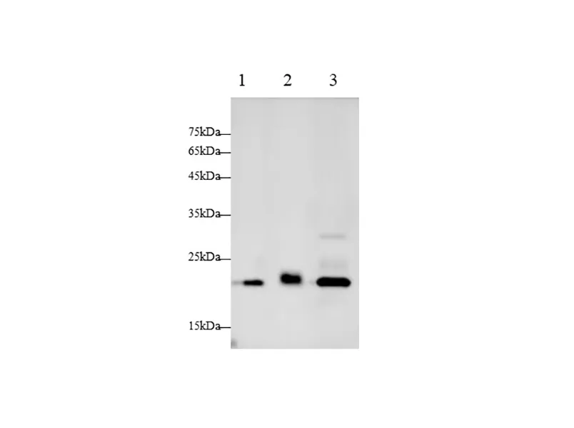 CTSB Polyclonal Antibody - image 1