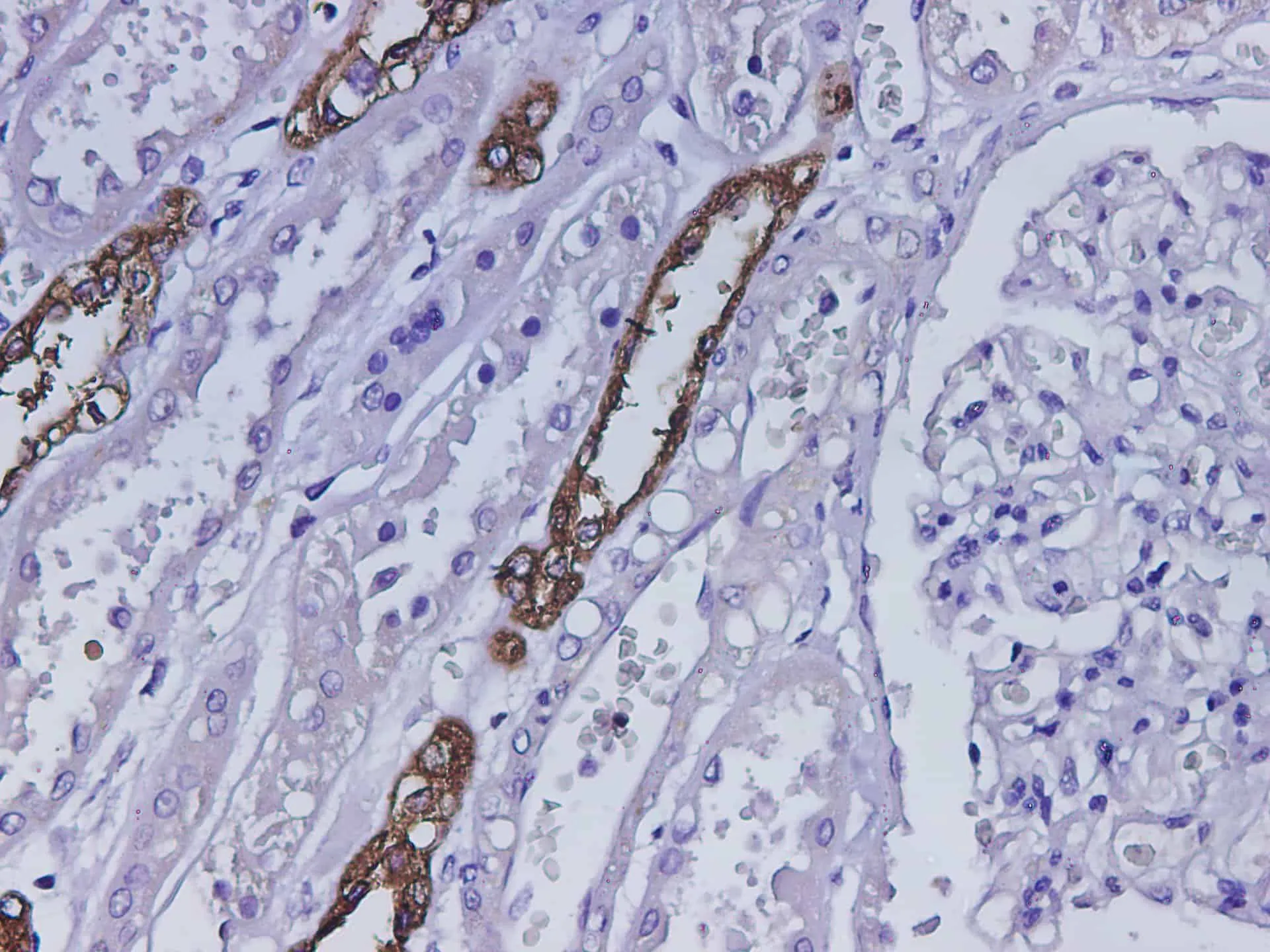 UMOD Polyclonal Antibody - image 1