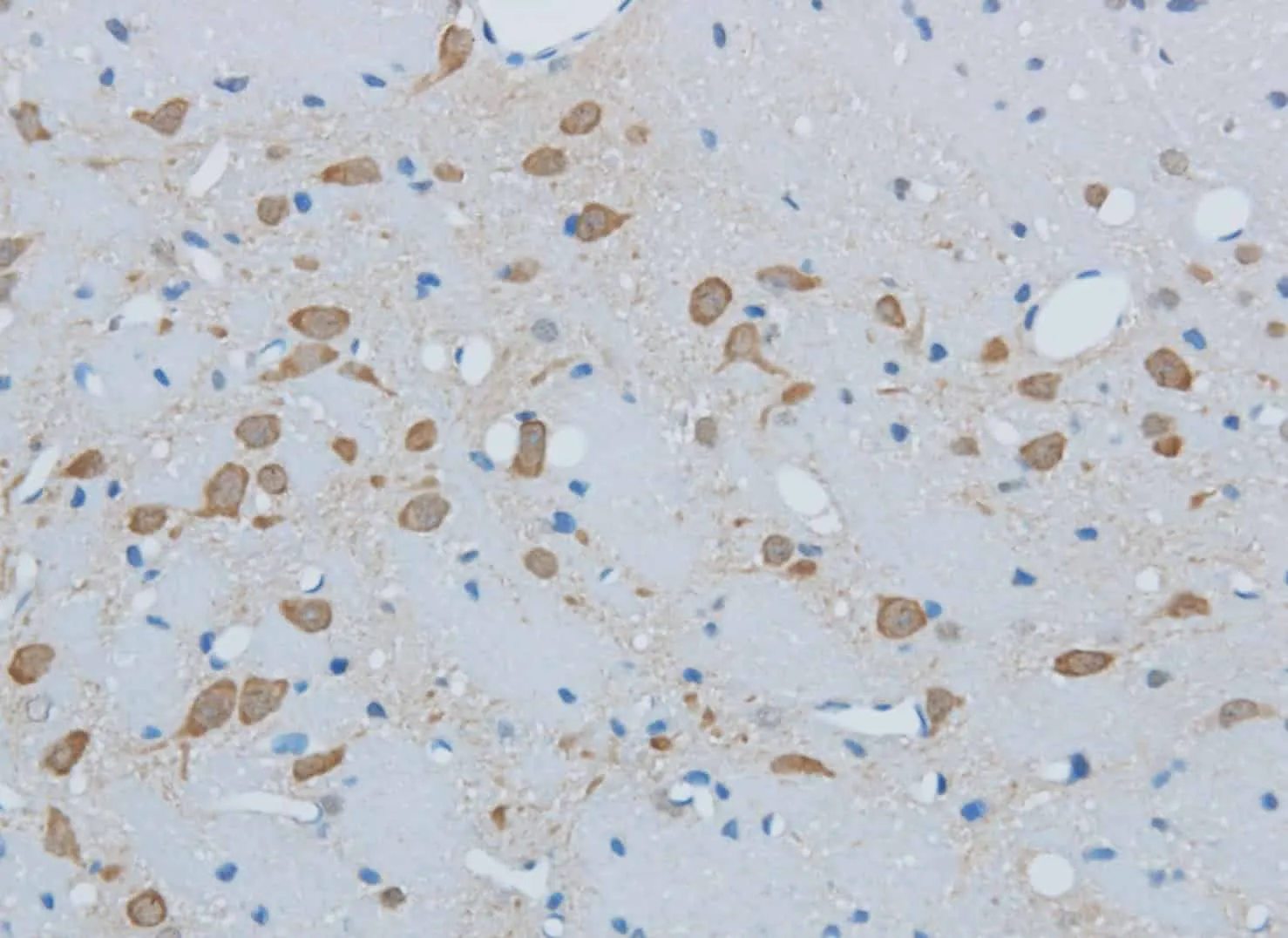 TIMP4 Polyclonal Antibody - image 1