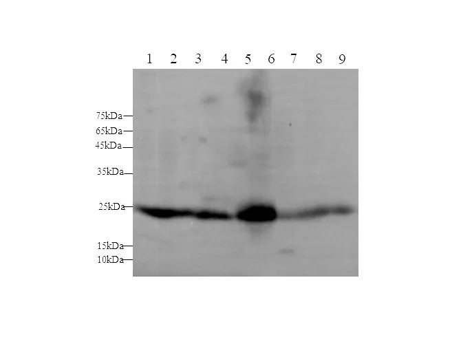 GSTA1 Polyclonal Antibody - image 1