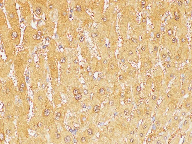 GSTA1 Polyclonal Antibody - image 2