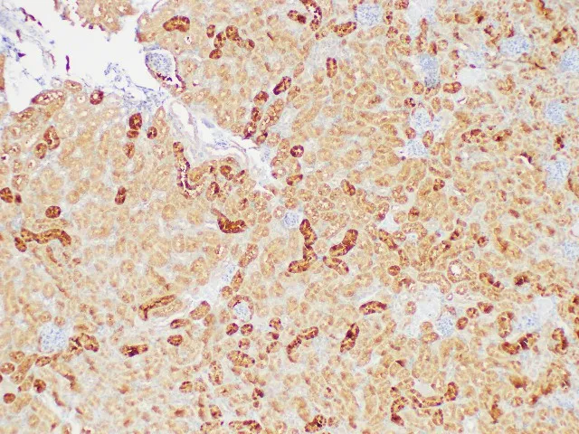 GSTA1 Polyclonal Antibody - image 3