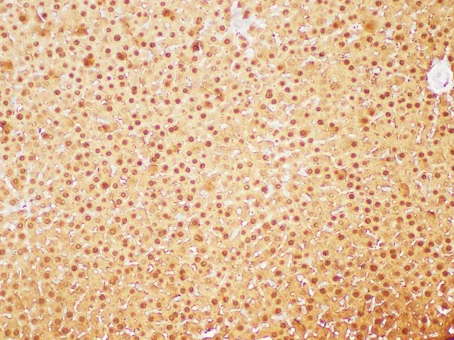 GSTA1 Polyclonal Antibody - image 4