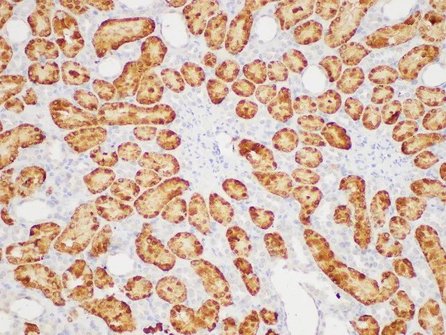 GSTA1 Polyclonal Antibody - image 5