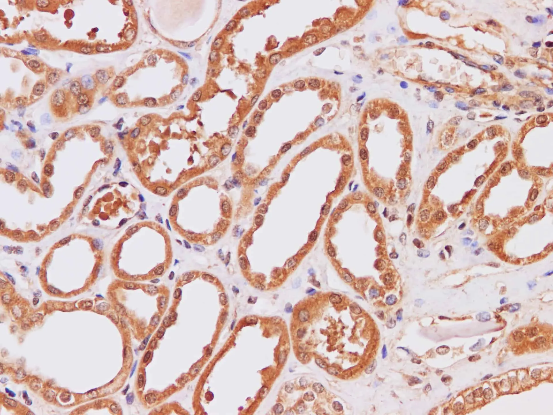 IP3KB Polyclonal Antibody - image 1