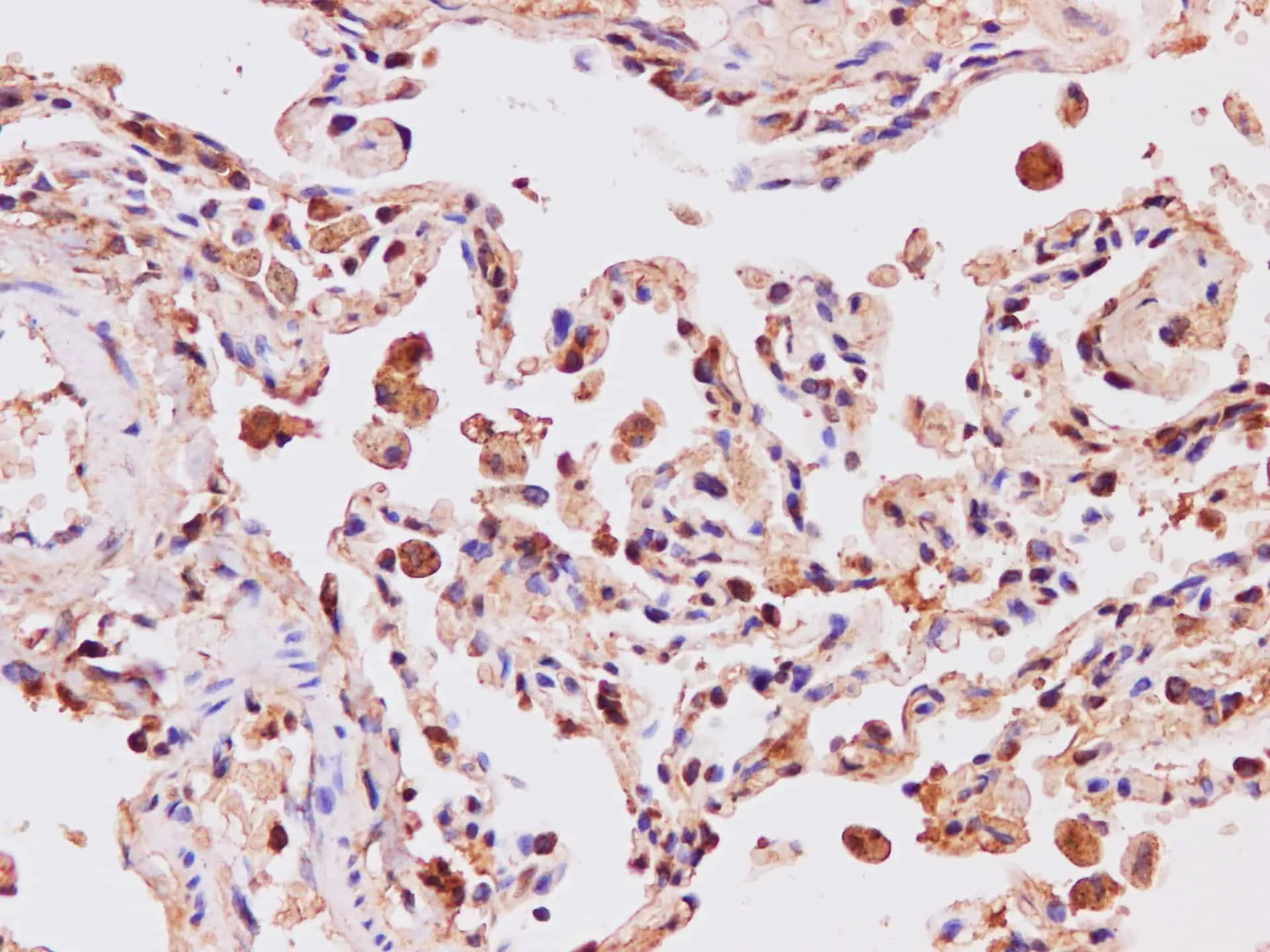 IP3KB Polyclonal Antibody - image 2