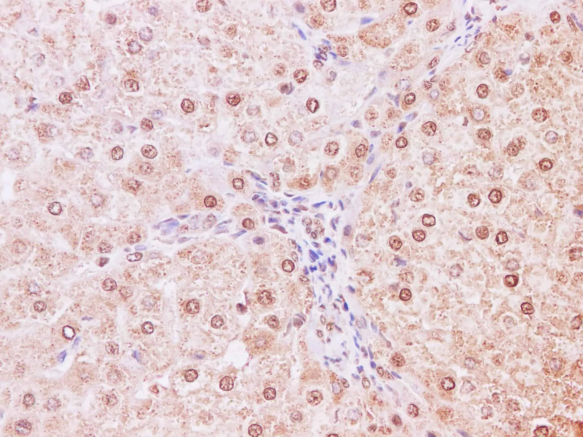 NEDD8 Polyclonal Antibody - image 1