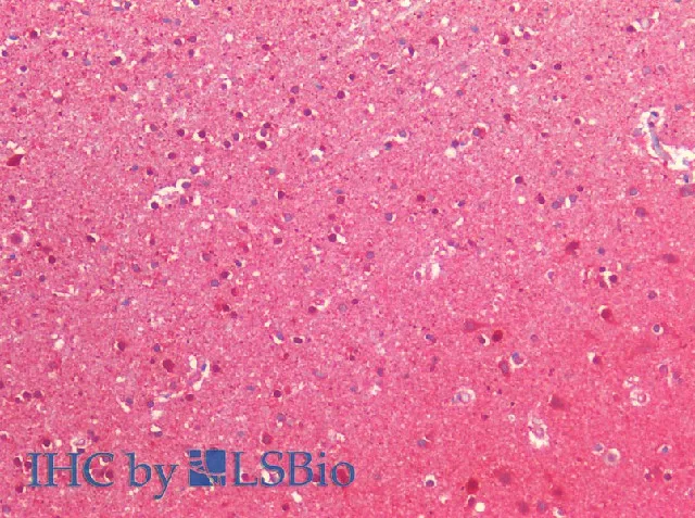 NEDD8 Polyclonal Antibody - image 2
