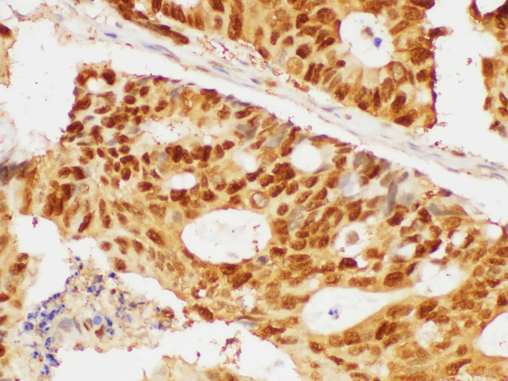PCNA Polyclonal Antibody - image 2