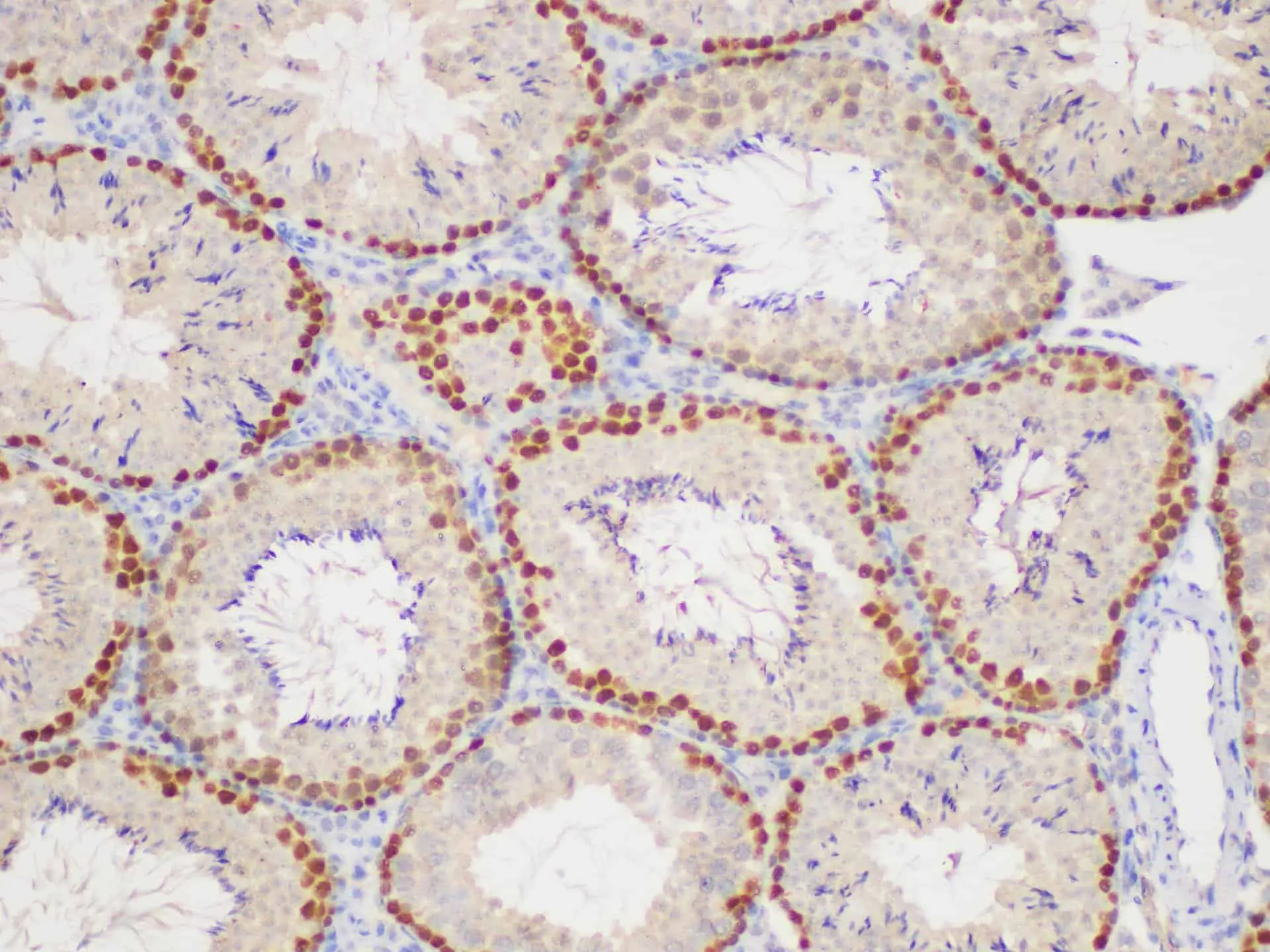 PCNA Polyclonal Antibody - image 3