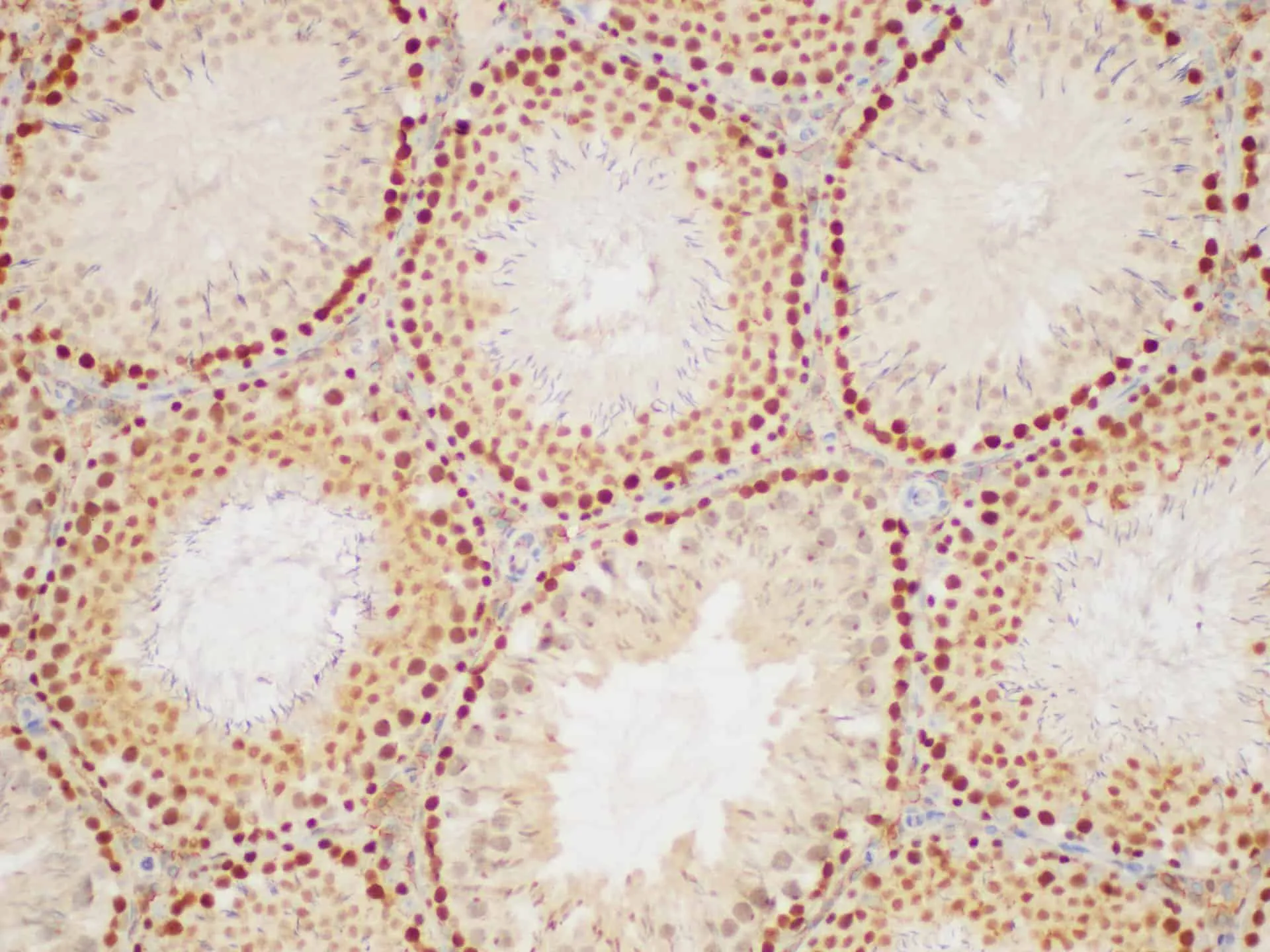 PCNA Polyclonal Antibody - image 4
