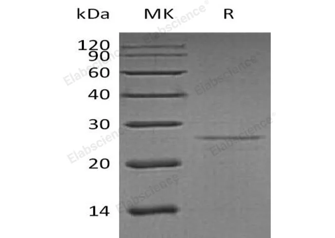 Recombinant Human EIF4E Protein - image 2