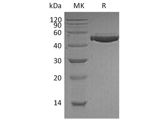 Recombinant Human Complement Factor H/CFH Protein (His Tag) - image 2