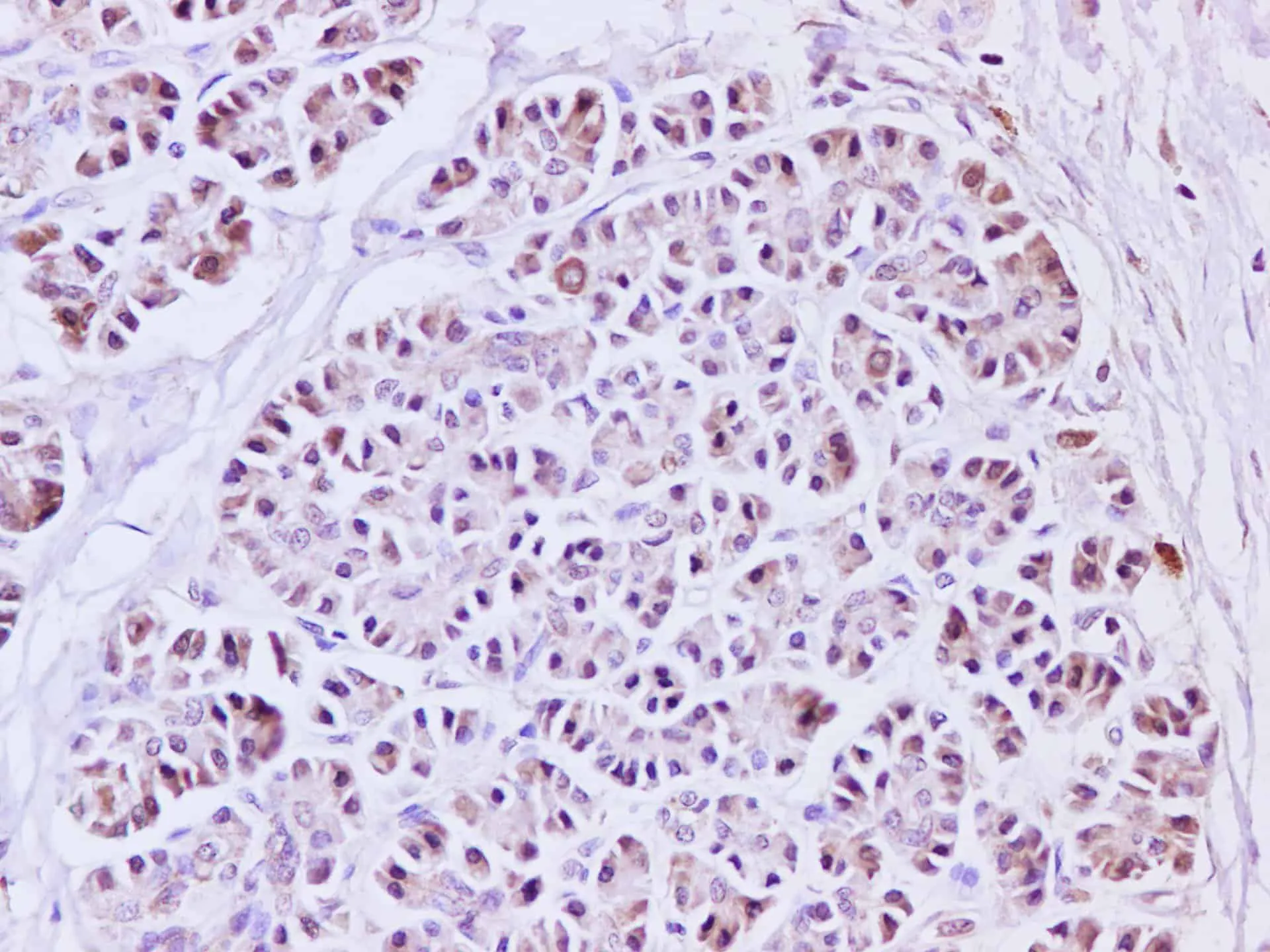 IL1A Polyclonal Antibody - image 1