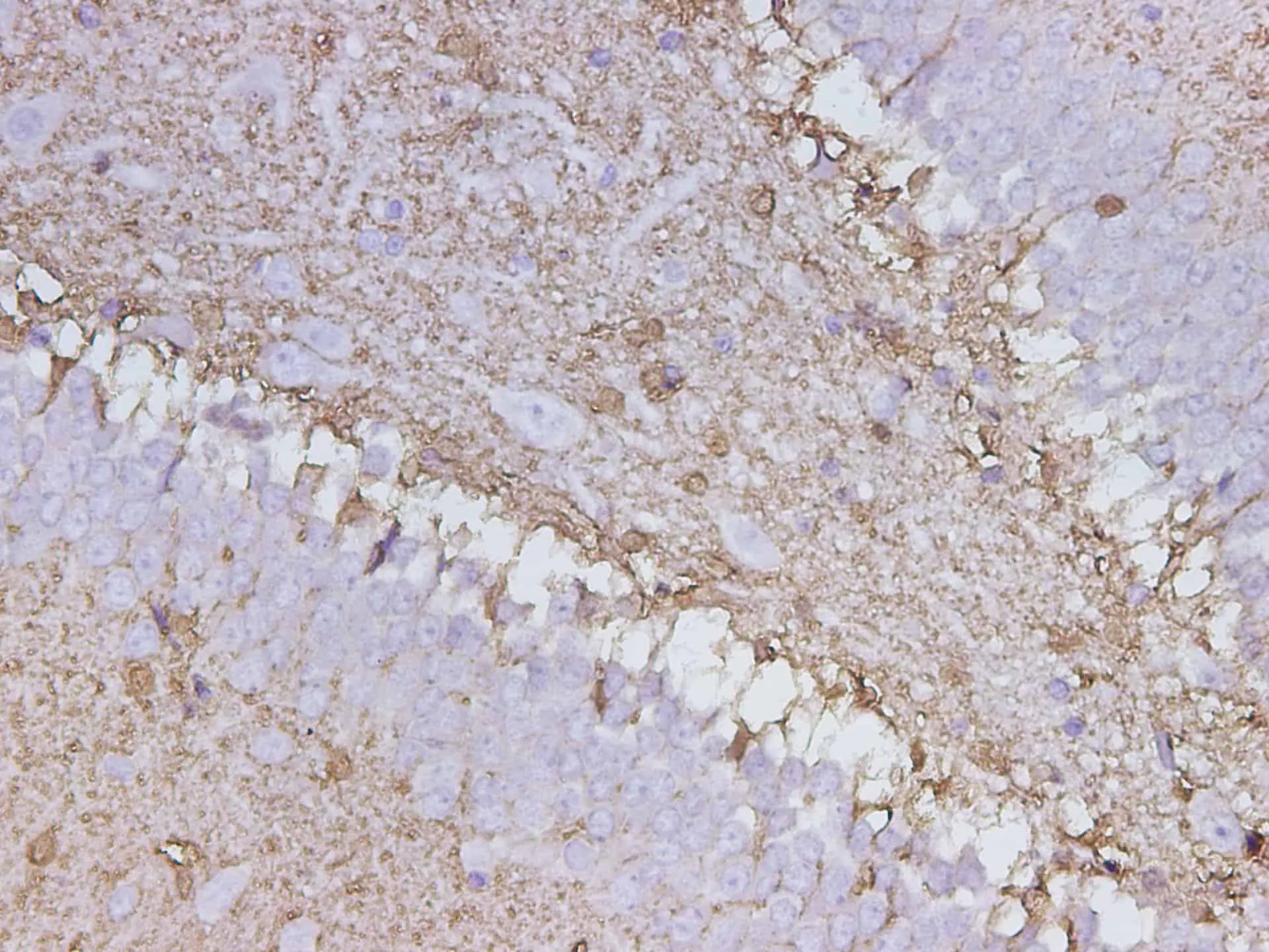 S100B Polyclonal Antibody - image 1