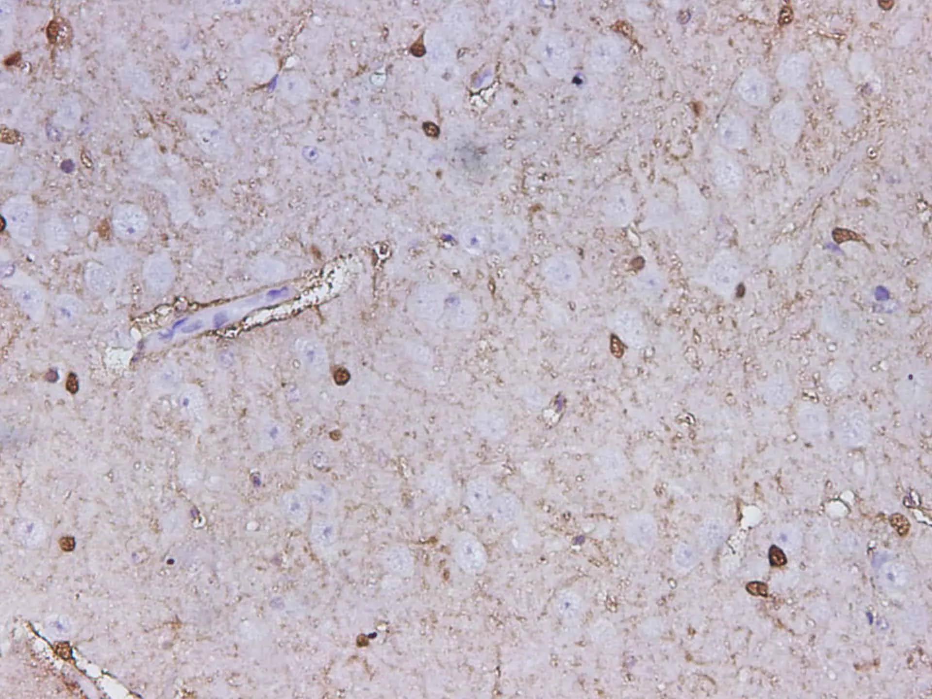 S100B Polyclonal Antibody - image 2