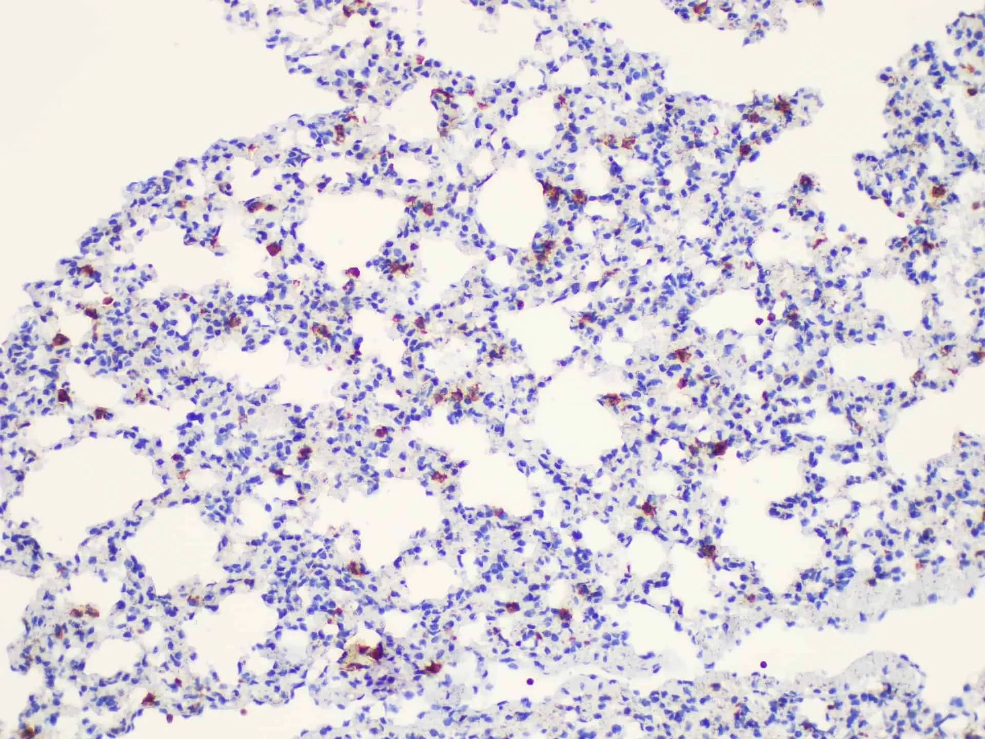 Galectin 3 Polyclonal Antibody - image 3