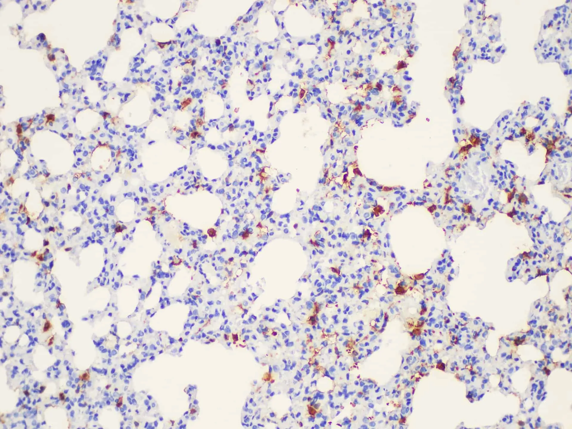 Galectin 3 Polyclonal Antibody - image 4
